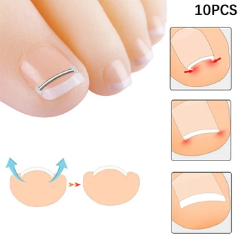 Инструменты для коррекции вросших ногтей на ногах для педикюра для восстановления Вросших ногтей на ногах Профессиональная коррекция вросших ногтей на ногах